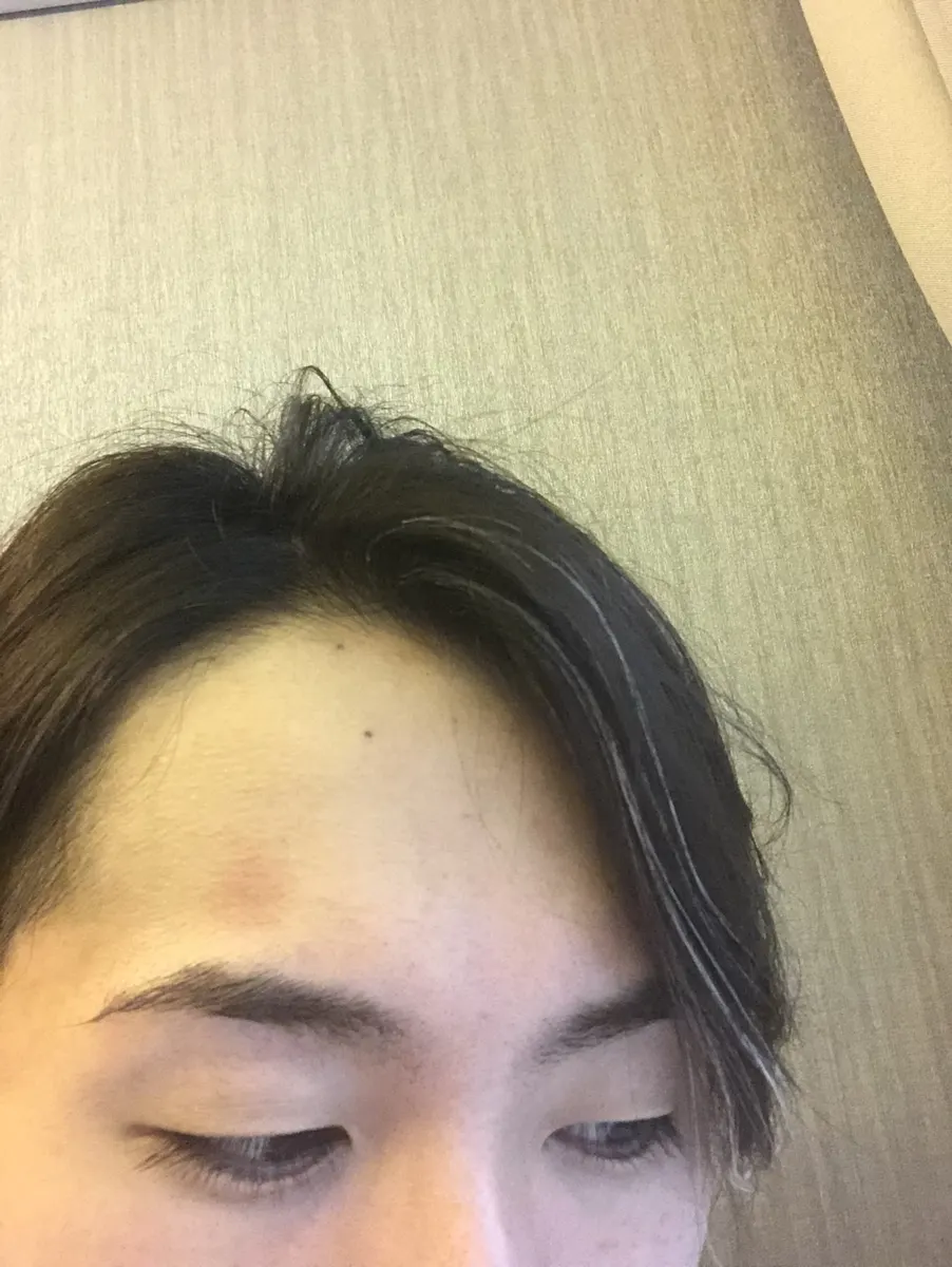 【3D増毛】ヘアループがやって来る!!【バンコク初上陸】
